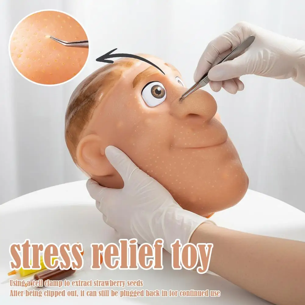 لعبة تخفيف الضغط والتنظيف للرؤوس السوداء، نسخة مطورة لحب الشباب، يمكن أن تحل محل حب الشباب المنفجر