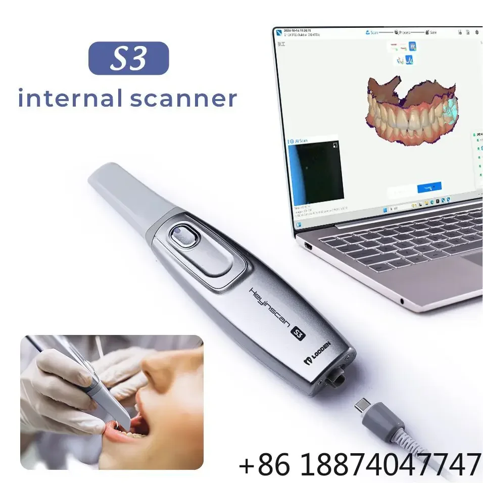 3D True Color and Al Scan Oral Scanner 3D Intraoral Scanner Tooth 3d Scanner fast shipping