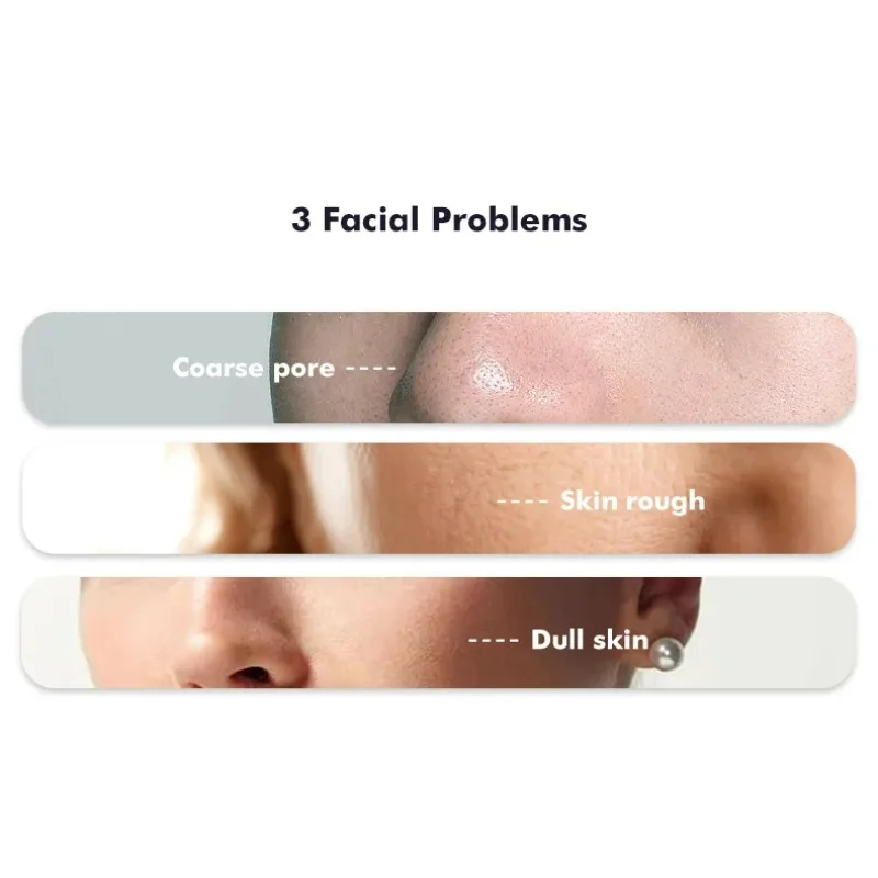 Wholesale New Generation Product Face Massager Vibration Microcurrent Facial  Home Use Beauty Device