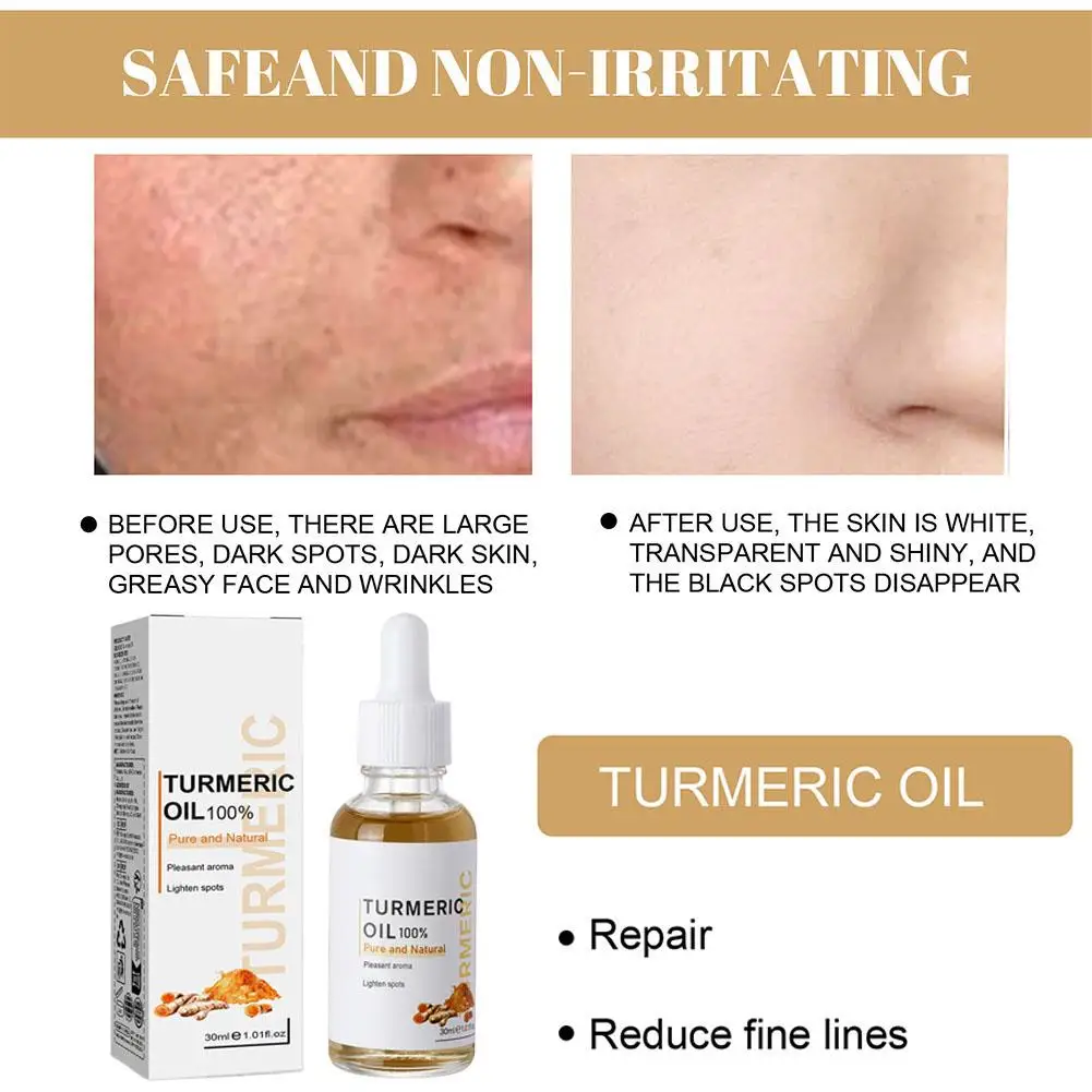 Remove Dark Spots Whitening Moisturizing Skin Care Anti Wrinkle Face Serum Turmeric Essential Oil Therapeutic Acne Shrink Pores