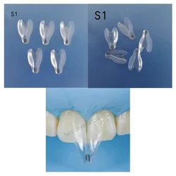 5Pcs Dental Widening Front Tranparent Clear Matrix BT Matrices Fits BioClear S1