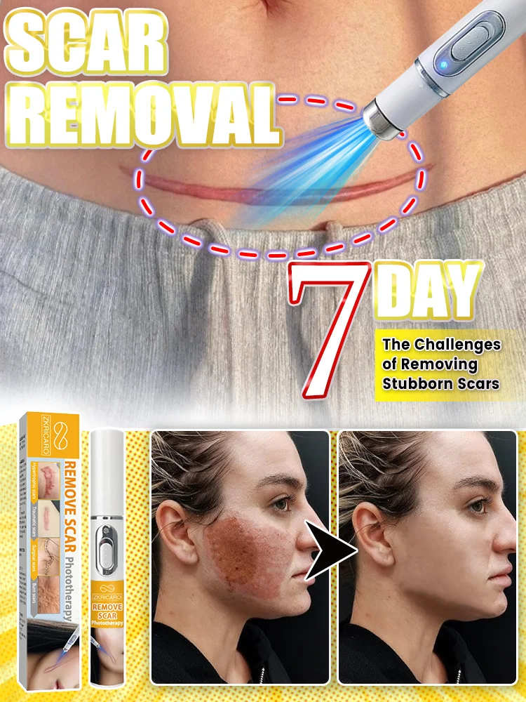 Dispositif laser de qualité médicale, économisez votre peau!