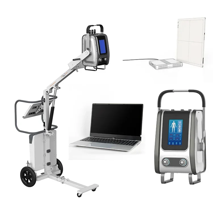 SONTU60 5kw/8kw Portable digital x-ray machine Wireless 14*17 FPD