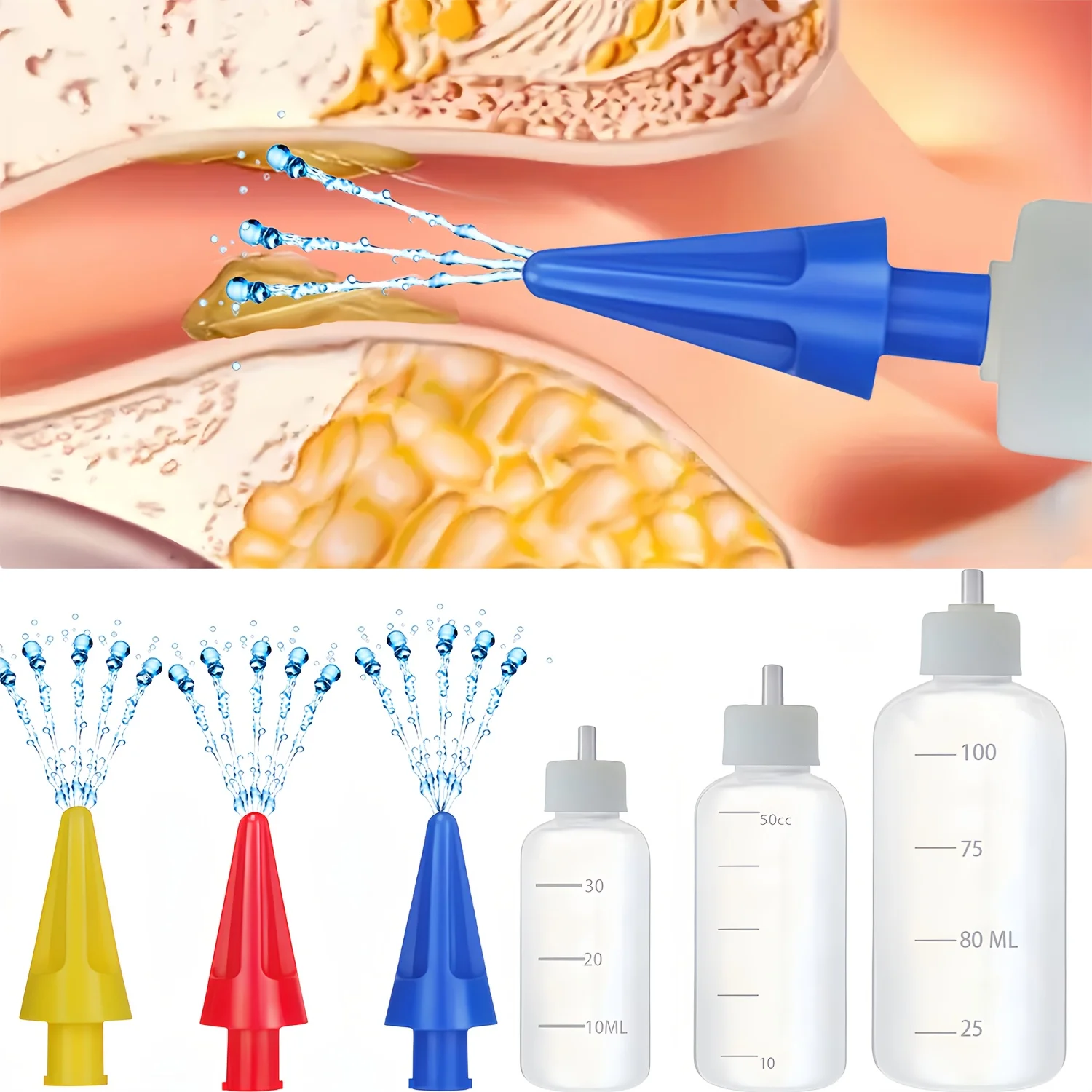 Kit de nettoyage des oreilles manuel, composé de 3 têtes de nettoyage des oreilles à 5 trous, associées à 3 bouteilles à presser de différentes capacités (30 ml/50 ml/