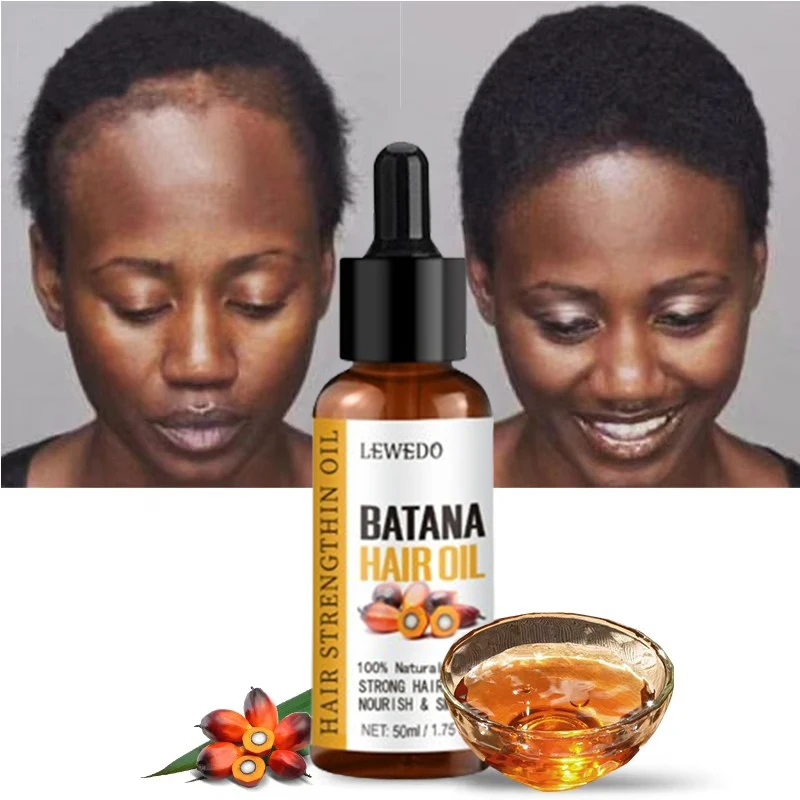 Lewedo Naturals Batana Oil Fast Hair Growth for Men Women Pure Batana Oil Nourish Shiny Hair Healthy Hair Care Anti Hair Loss