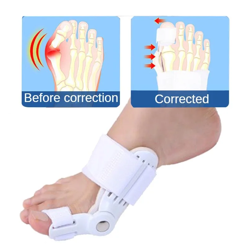 

Bunion Splint Big Toe Straightener Corrector Feet Pain Relief Hallux Valgus Correction Orthopedic Supplies Pedicure Foot Care