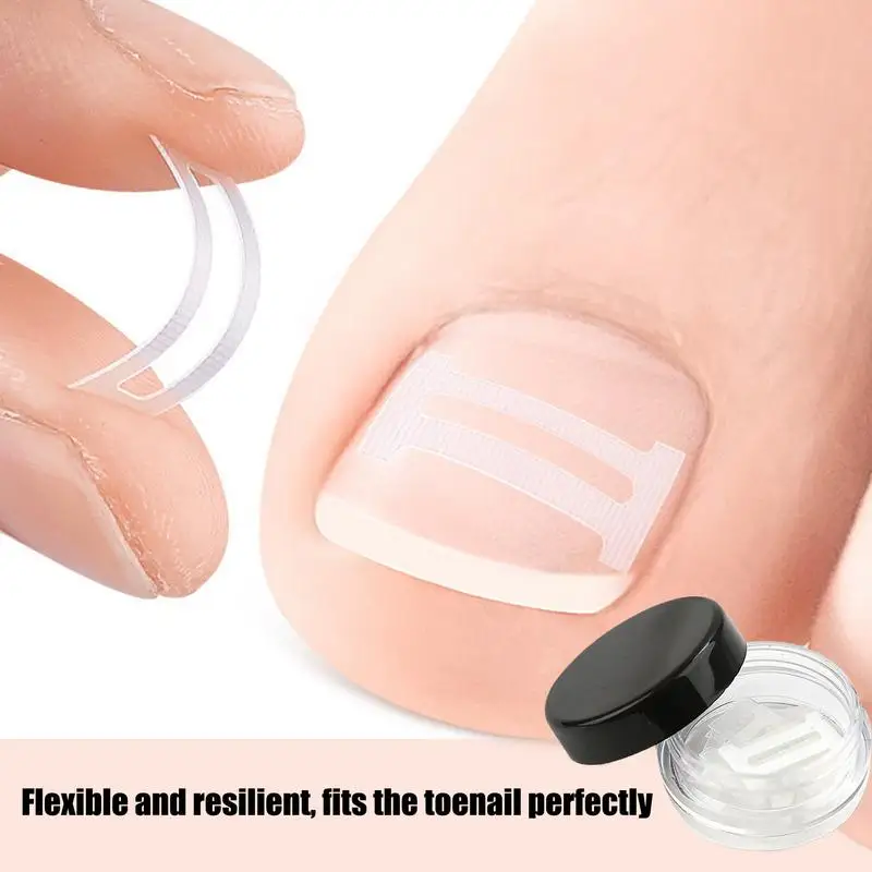 10 pçs tratamentos de unhas encravadas ferramenta de correção de unhas encravadas adesivo de remendo elástico ferramenta de correção de unhas encravadas