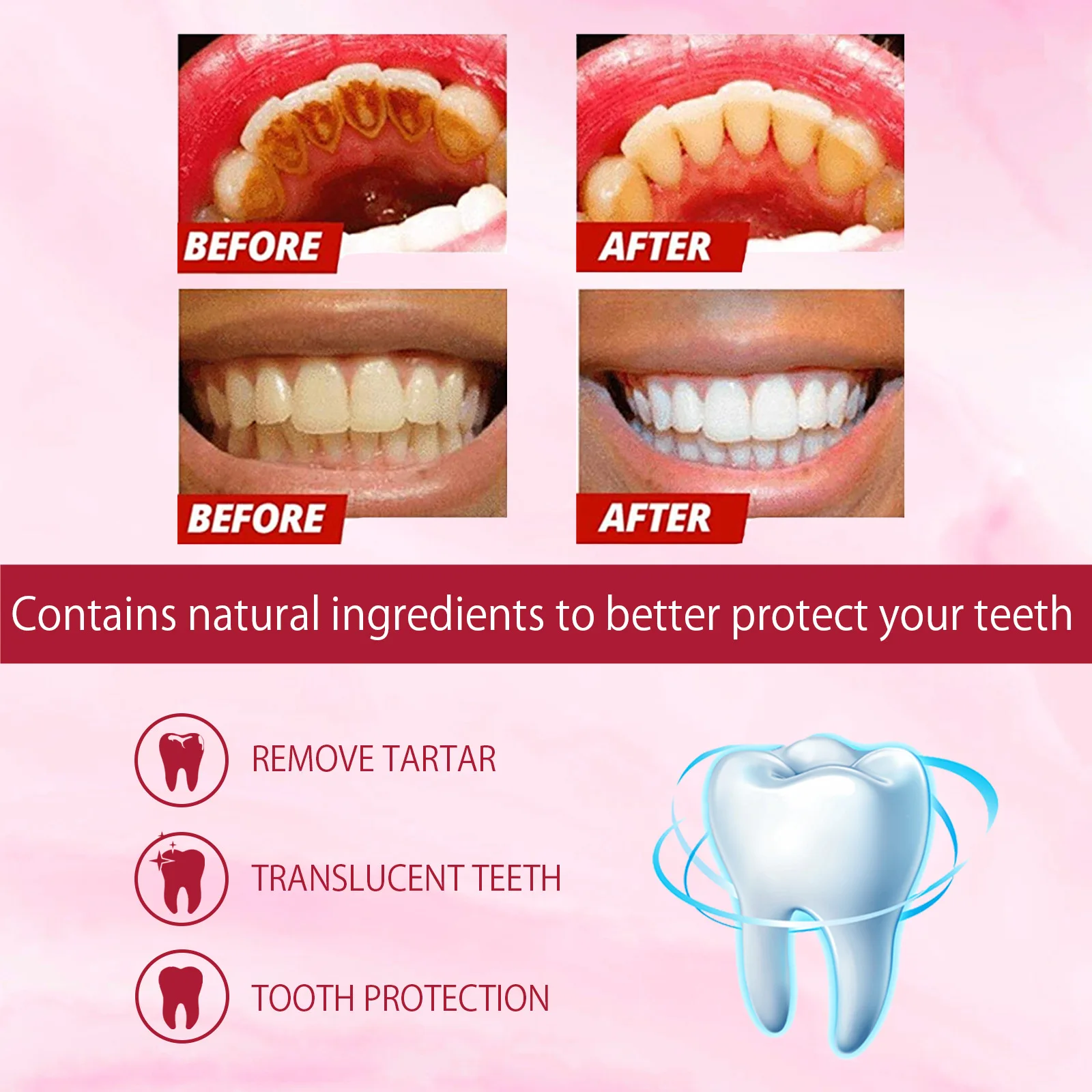 120g Probiotic Toothpaste SP-4 Whitening Tooth Remove Plaque Stains Teeth Whitener Oral Hygiene Clean Fresh Breath Dental Tools