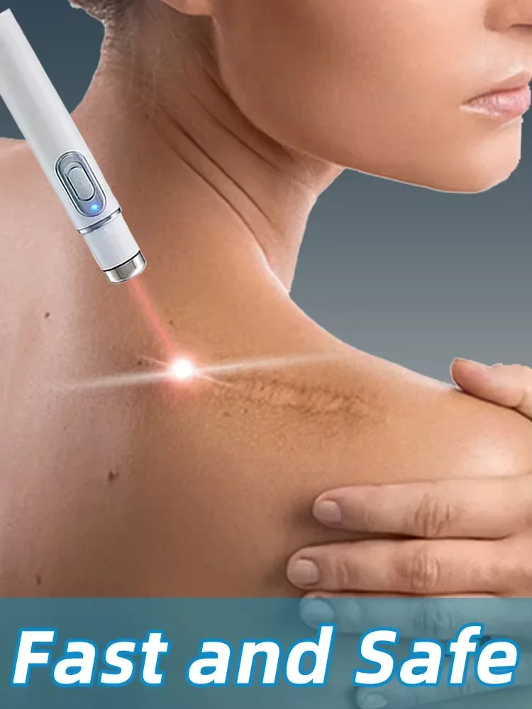 Laser highly effective keloid repair