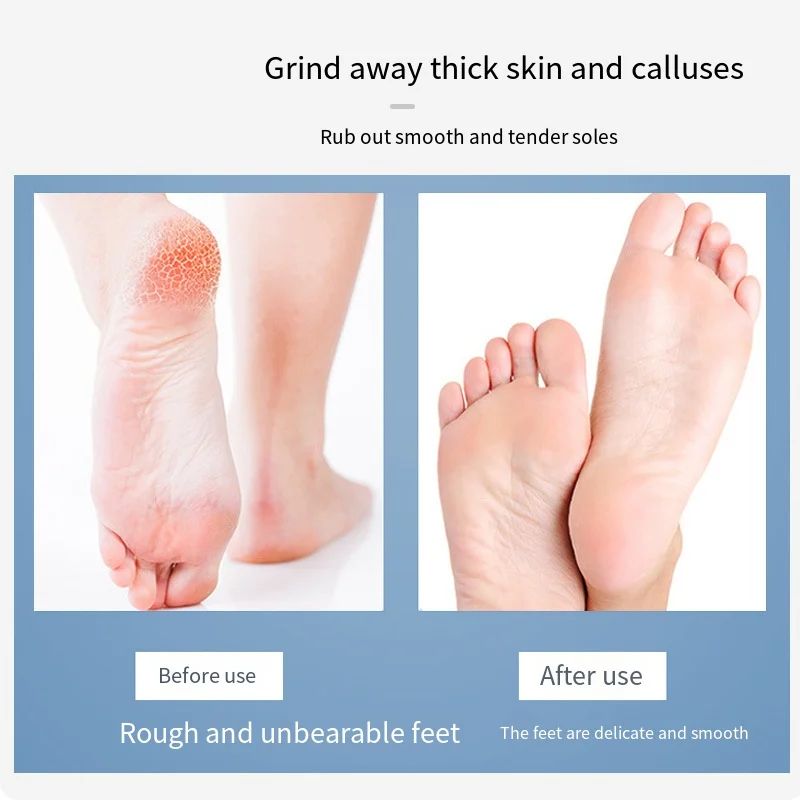 Lima per piedi professionale in acciaio inossidabile, pieghevole su due lati, per rimozione calli della pelle morta, strumenti per pedicure, grattugia esfoliante