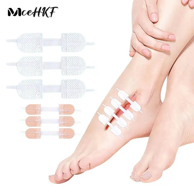 

3Pcs Outdoor Portable Zipper Tie Wound Closure Patch Skin Care Hemostatic Patch Wound Fast Suture Zipper Band-Aid