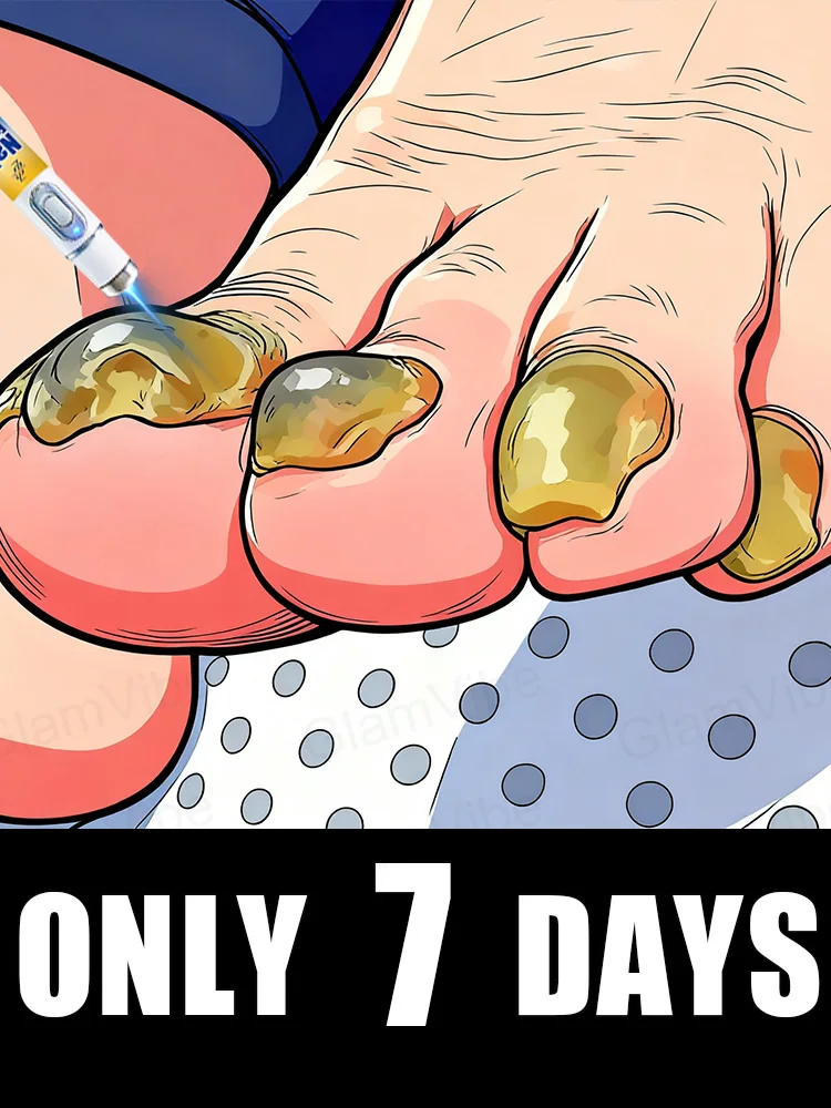 

2025 Tᴏᴇɴᴀɪʟ Fᴜɴɢᴜs Pᴀᴛᴄʜᴇs Rᴇᴘᴀɪʀ Dɪsᴄᴏʟᴏʀᴇᴅ Dᴀᴍᴀɢᴇᴅ Nᴀɪʟs Fᴏᴏᴛ Cᴀʀᴇ