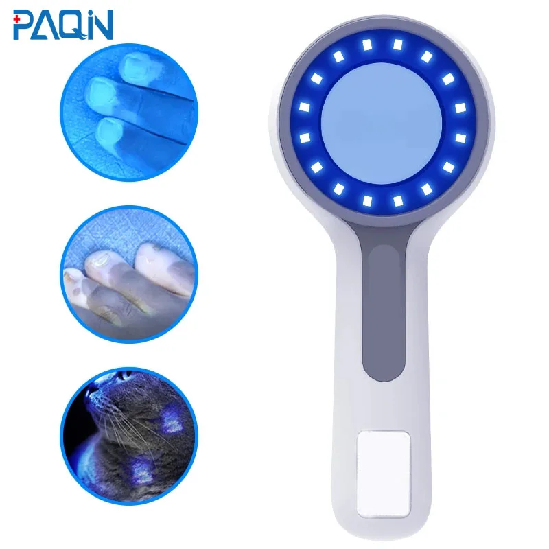 Dermatoscope Skin Medical Magnifier Detection Woods Lamp  UVA Lamp For Vitiligo Detection