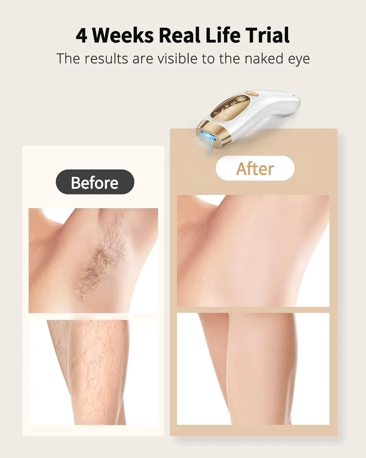 Laser Hair Removal 9 Levevls Unlimited Flash IPL Hair Remover Ice Cooling Painless & Long-Lasting Results Full Body Treament