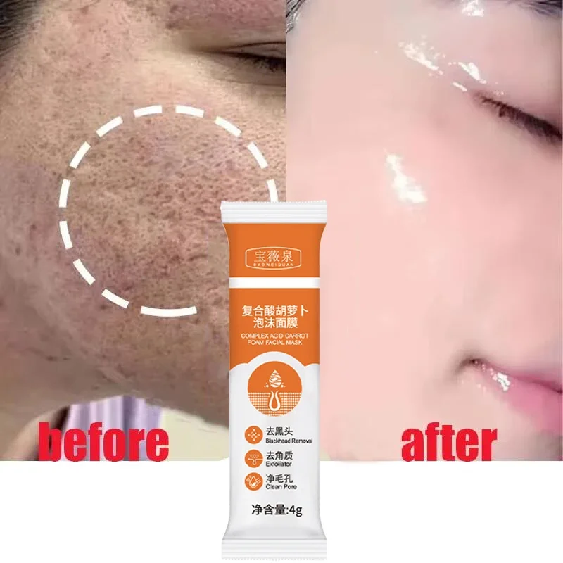 Face Cleaning Bubble Mask Shrinking Pore Remove Blackhead Deep Cleaning Oil Control Anti-Acne Brighten Whitening Face Skin Care