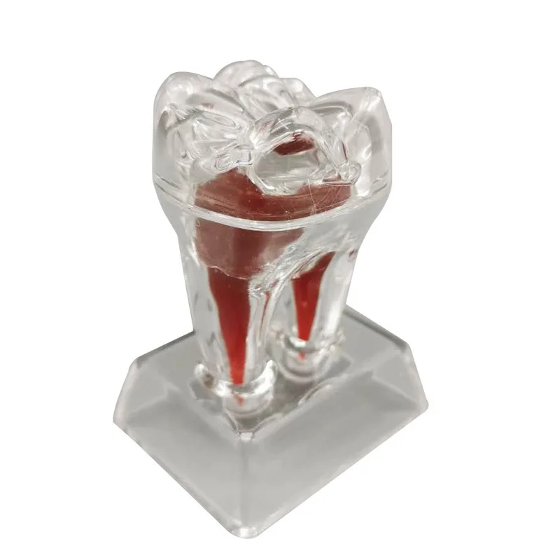 

5Pcs Dental Mold 4 Times Larger Tooth Model Dental Pathology Analysis 70mm Luminous Tooth Structure Decomposition Model