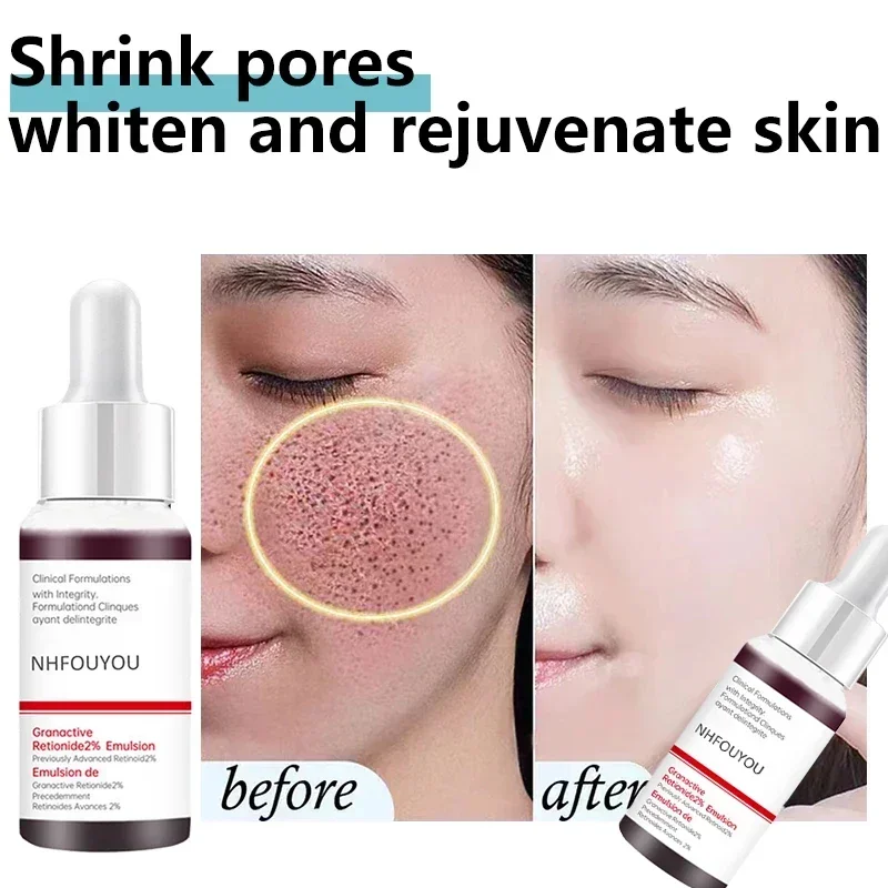 Pore Shrinking Serum Face Removing Large Pores Tightening Repairing Facial Pore Minimizing Essence Skin Care Products