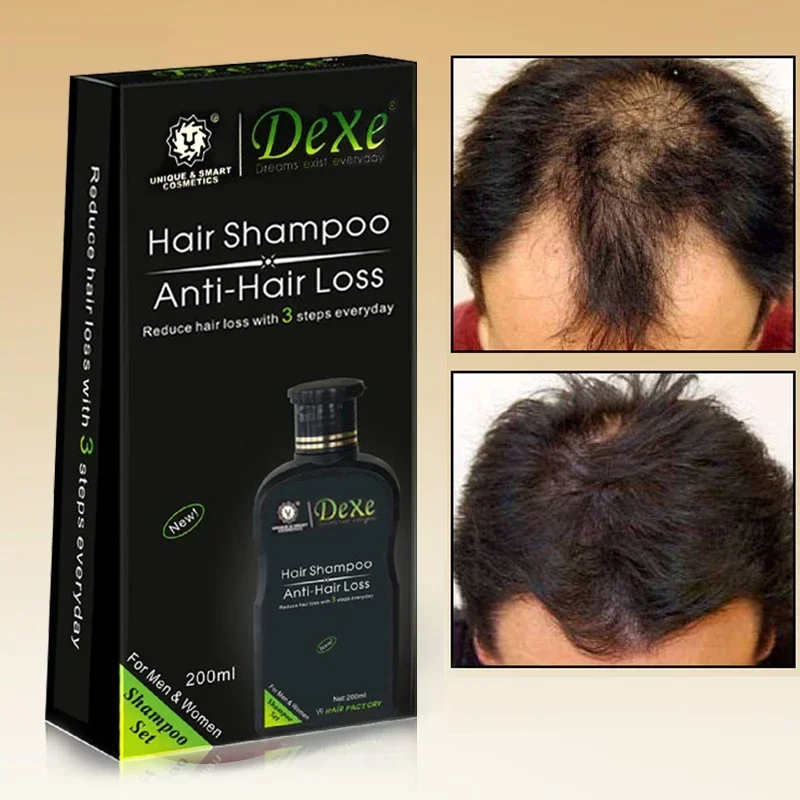 

Professional hair growth Shampoo Anti-hair Loss Chinese Hair Growth Product Prevent Hair Treatment for Men Women Care Unisex