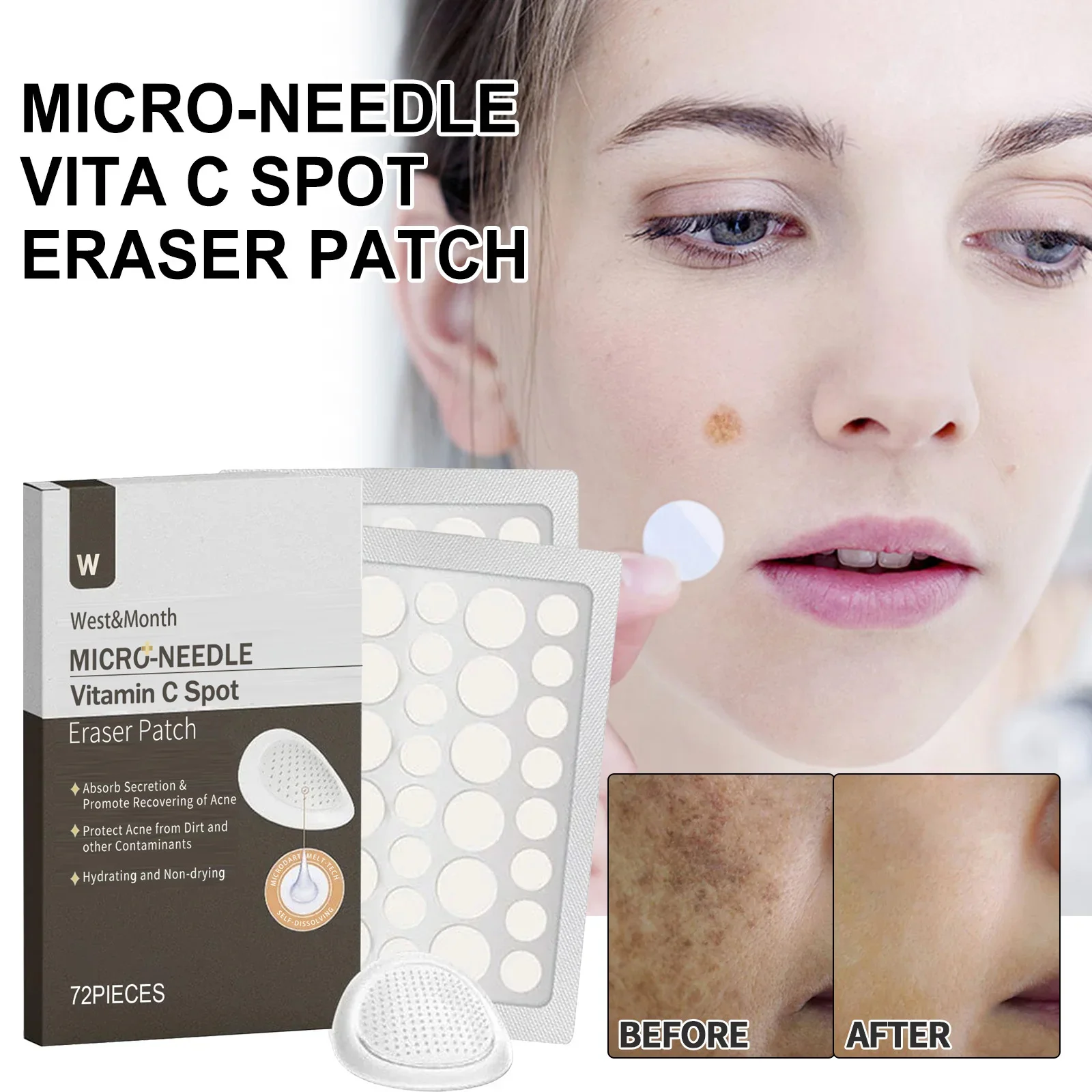 

72pcs Niacinamide Face Spot Patch Vitamin C Removal Freckle Dark Spots Corrector Stickers Pimple Spot Scar Acne Mask Beauty Care