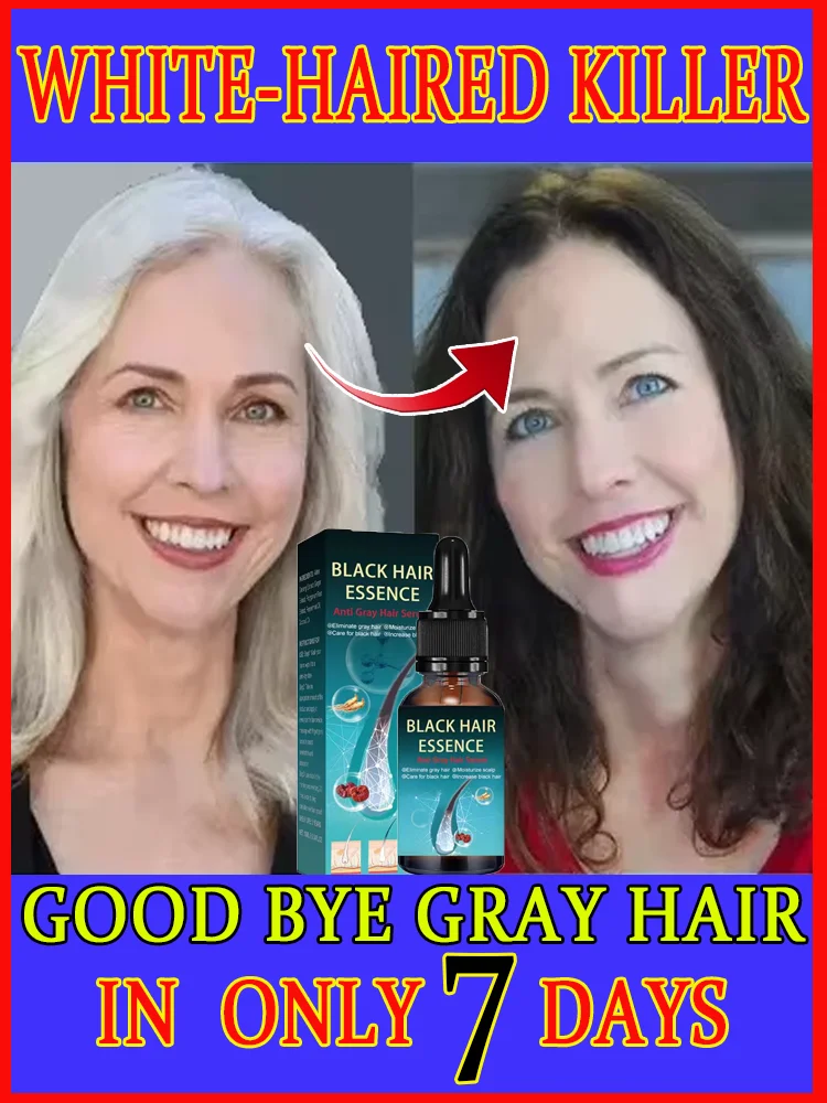 

Young people have white hair, white to black, No hair color, no allergies quickly turnsinto black hair, repairs natural color