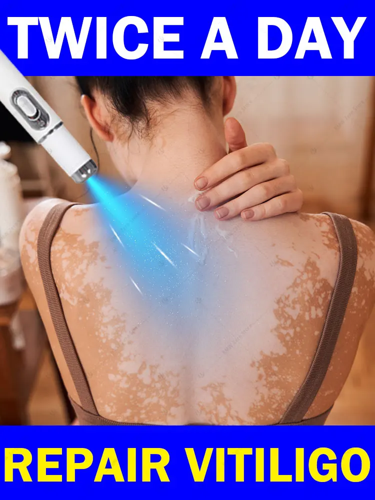 เทคโนโลยีเลเซอร์ใหม่ TR 2025 ช่วยปรับปรุงโรคด่างขาวได้อย่างมีประสิทธิภาพ