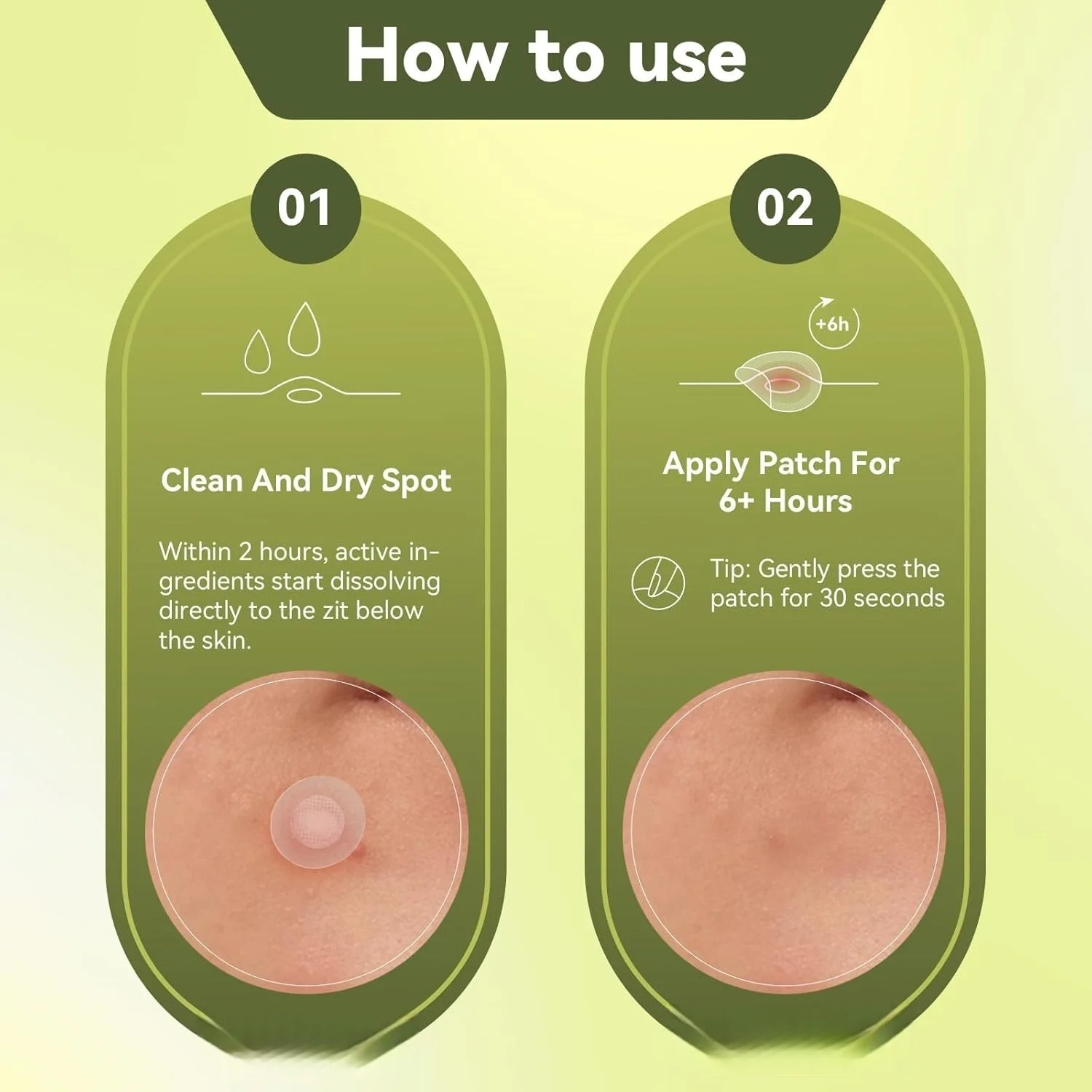 9/100pcs Your Secret to Smoother Skin: Pimple Patches for Hydration & Clarity.