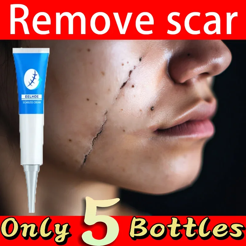 

Women's Beauty And Scar Removal Keeps The Face Moisturized And Repairs Damaged Skin Scar Postoperative scar repair