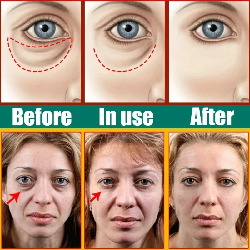 ﻿ Instant Eye Bag Dark Circles Removal Cream Firm Wrinkle Anti Fat Particles Fade Fine Lines Brighten Moisturize Korean Eye Care