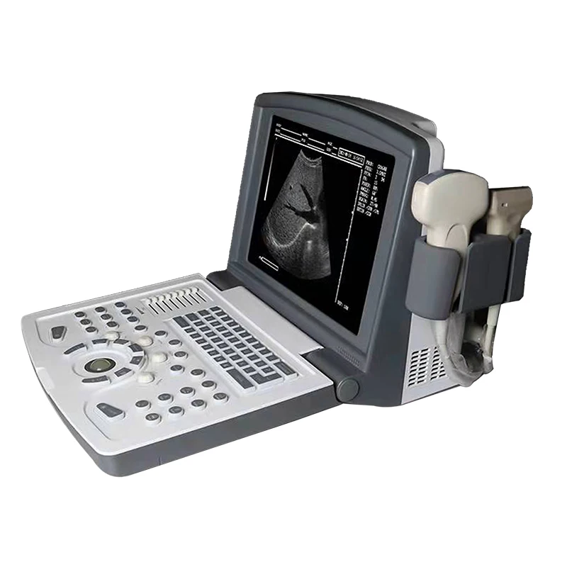 Portable Electric Ultrasound Machine Black White Imaging Full Digital System Featuring 12-inch LCD