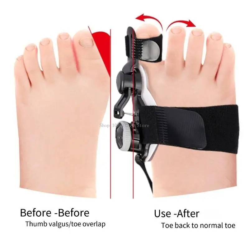  Kids Hallux Valgus Toe Splint Children Big Toe Corrector Adjustable Hallux Valgus Corrector for Day Night Support