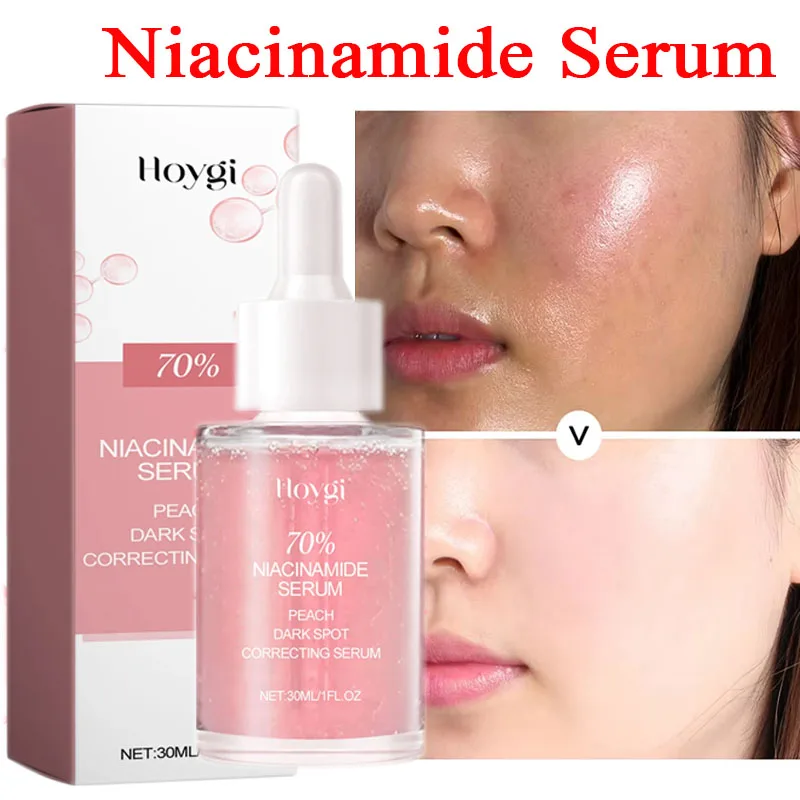 

Nicotinamide Serum Peach Black Spot Correcting Serum Fast Whitening Brighten Skin Improve Freckle Melasma Essence Care Korean