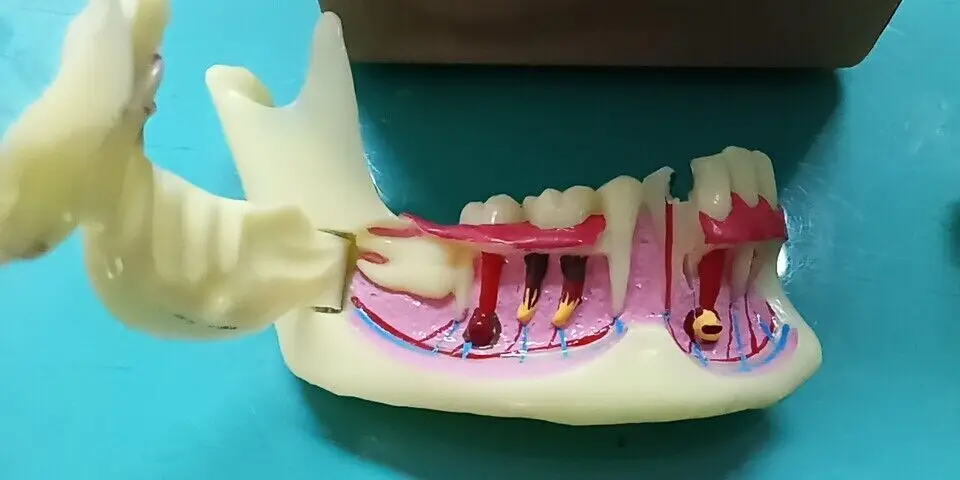 Teeth Model Dental Endodontic Treatment Model Anatomy of gums Dental Study Teach Model