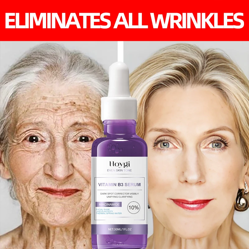 

Vitamin B3 Anti Wrinkle Facial Serum Anti Aging Lift Firming Essence Fade Fine Lines Anti Acne Spots Smooth Brighten Skin Care