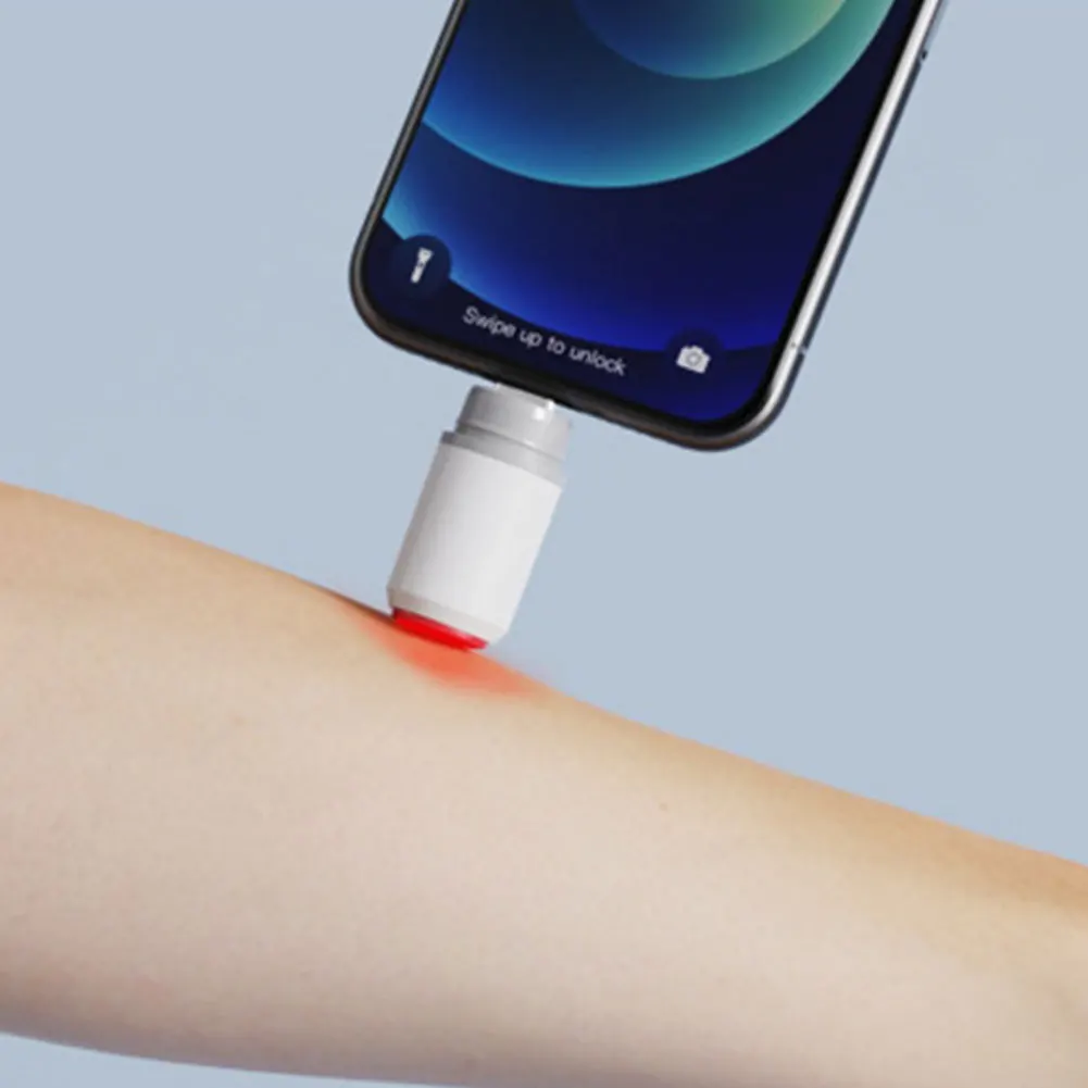 

Electronic Mosquito Bite Pen Natural Mosquito Bite Heat Pen Chemical-Free Electric Insect Bite Healer for Camping Travel Outdoor