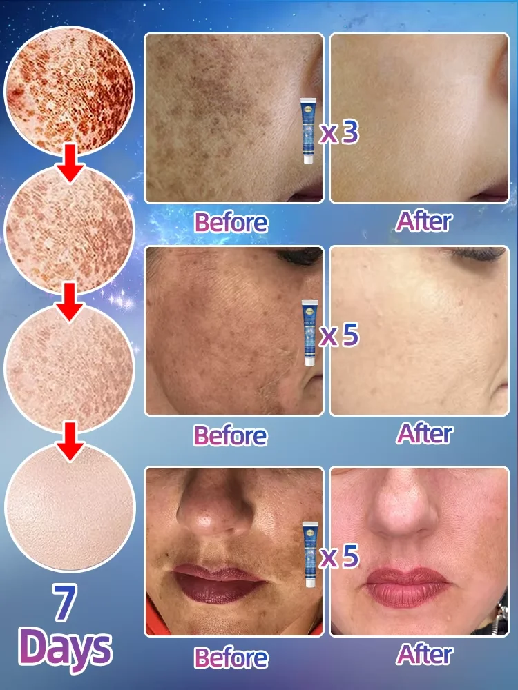 Ferramentas de cuidados faciais