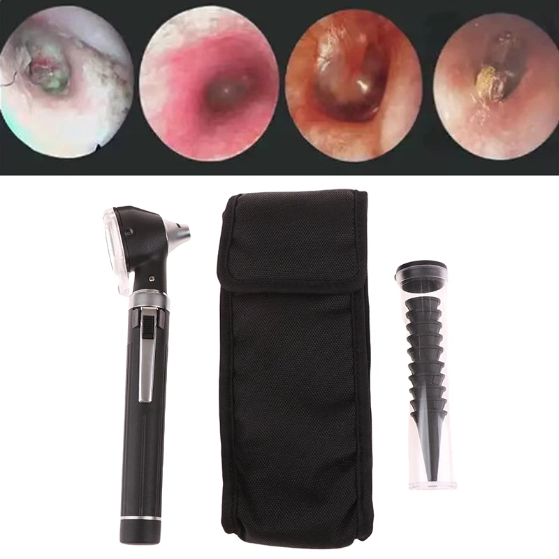Professional Portable Ear Care Examination Otoscopio Eardrum Endoscope Direct Otoscope Health Diagnostic With 10 Speculum Tip