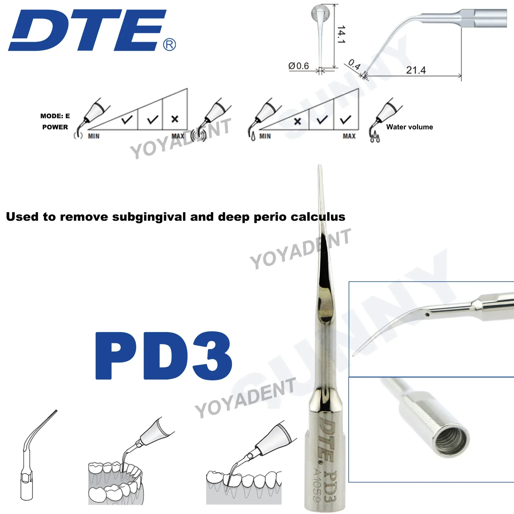 ウッドペッカー 超音波スケーラーチップ SATELEC ACTEON NSK対応