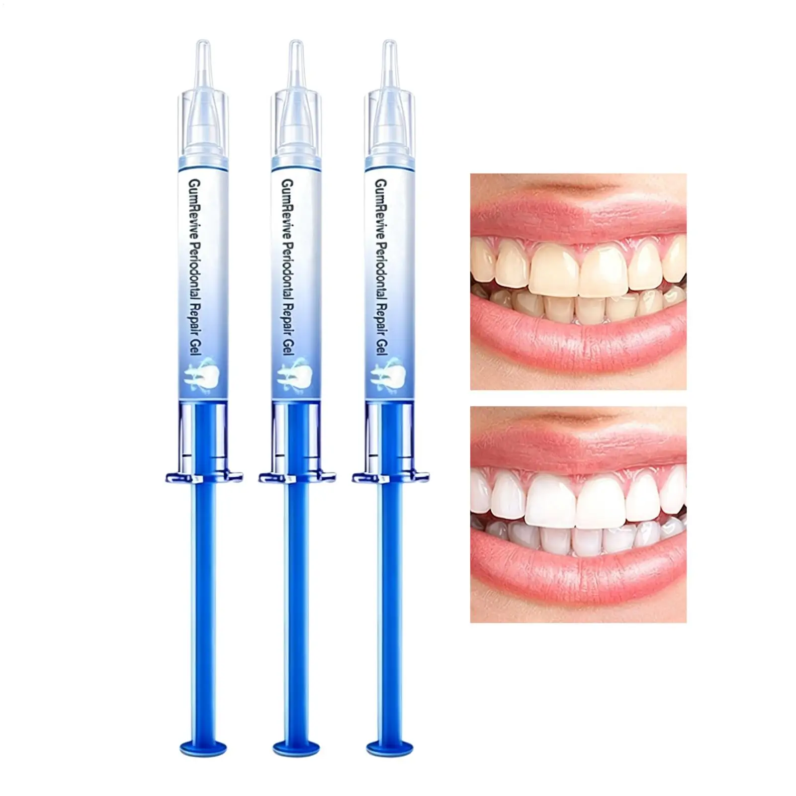 Teeth Repair Gel 3 Pieces Professional Color Correcting Solution Strengthening Gum Gel for Mouth Health Care Women Men