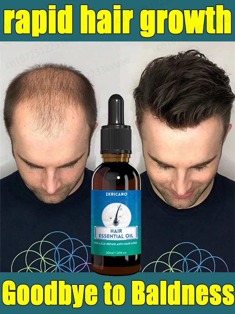 Grow new hair in 7 days, effectively repair baldness and hair loss