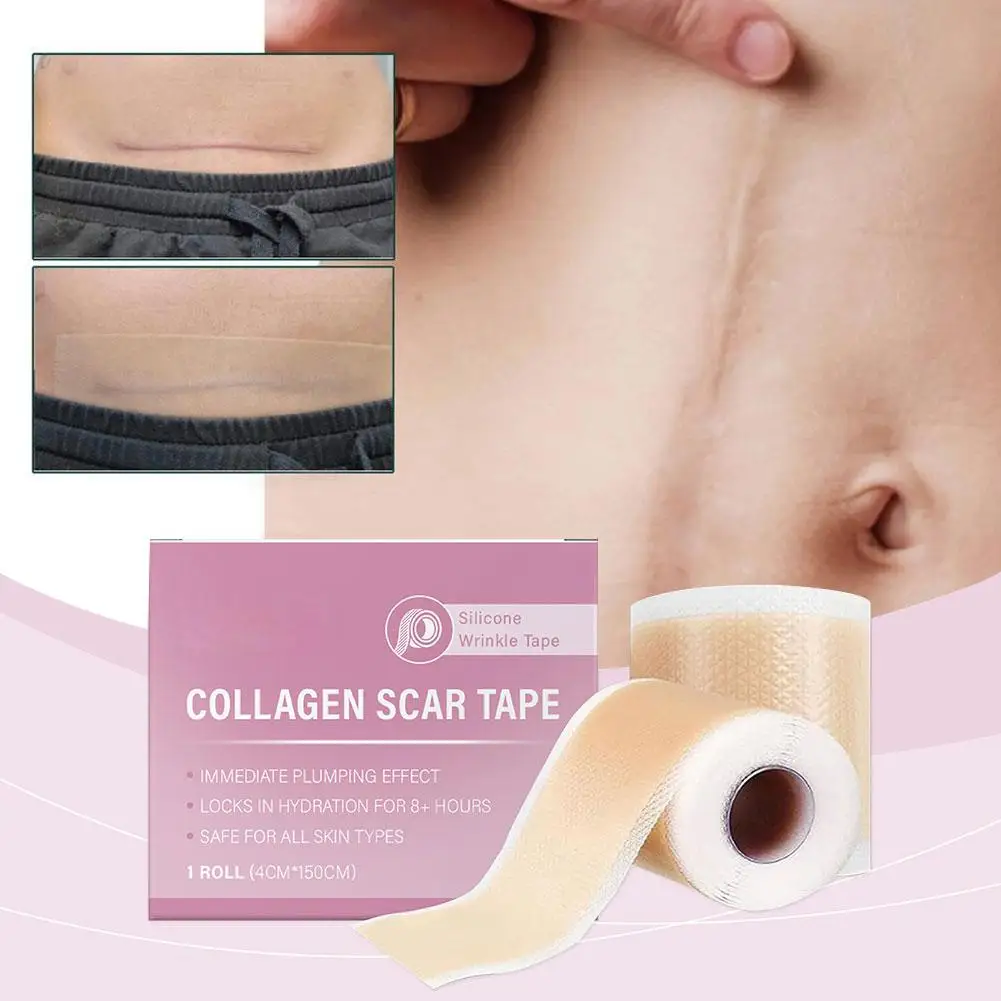 ملصقات ندبات الجسم تمييع الخطوط الدقيقة شفافة وغير مرئية تغطي العيوب شريط لاصق ذاتي لحرق حب الشباب الجراحية #4