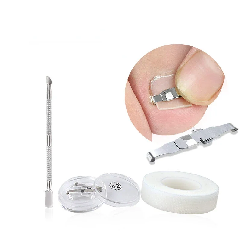 1 ensemble correcteur d'ongle incarné fixateur d'ongle orthopédique traitement de Correction d'ongle outils de soins des pieds outil de récupération intégré