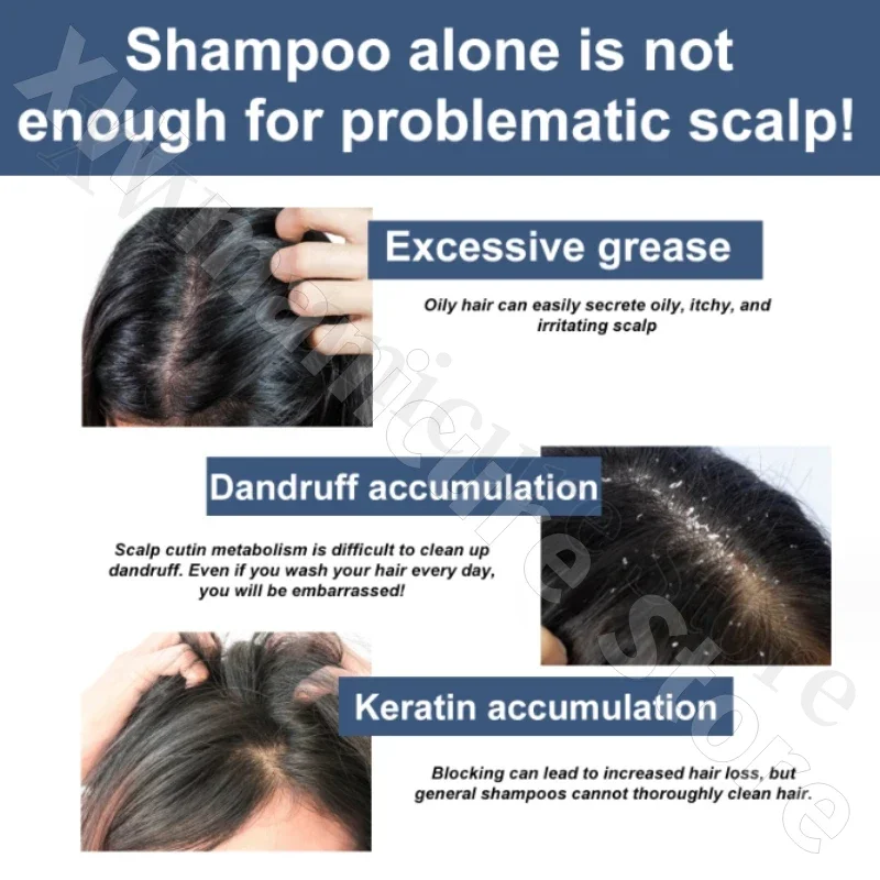 Anti-dandruff and Anti-itch Shampoo Plant Extracts Deep Cleansing Improving Scalp Barrier Oil Control Fluffy Exfoliating Shampoo