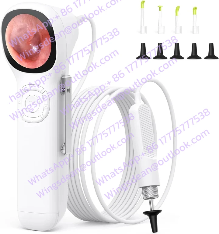 Electric Digital with 1.45 Inch IPS Screen Plastic Material Assist in Ear Wax Removal and Detailed Ear Examinations