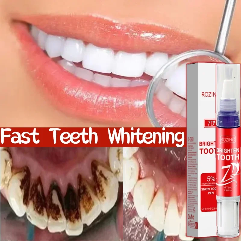 Tooth Whitening Pen Dazzling White Teeth Whitening Pen Instant Teeth Whitening Pen Brighten Your Smile Tooth Hygiene Care Tools
