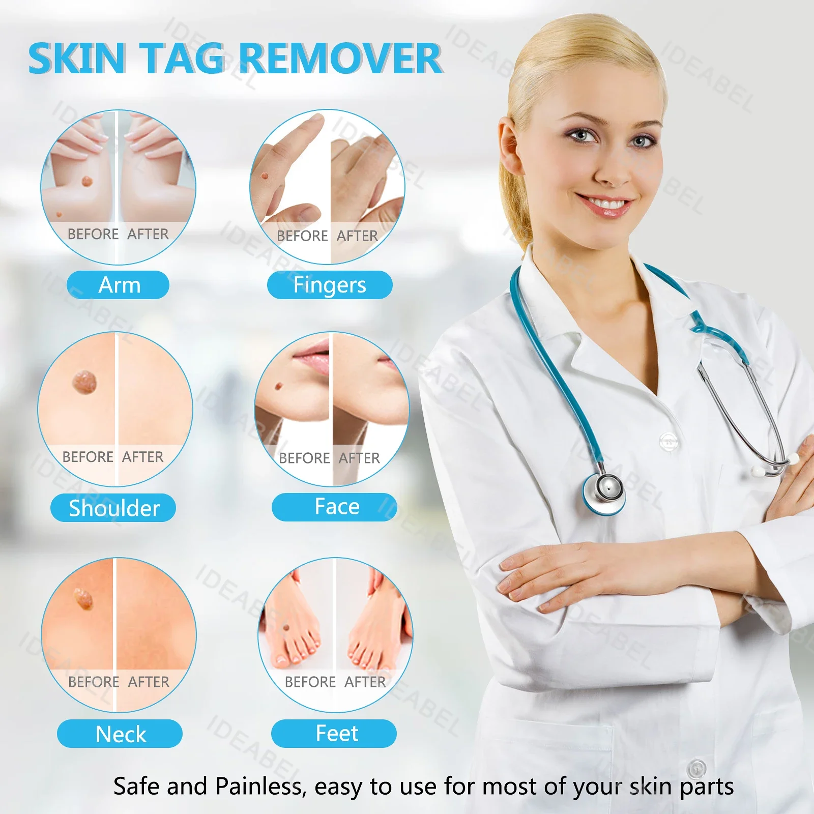 Skin Mole Removal Kit 3 In 1 Skin Warts Removal Kit Auto Skin Tags Remover Pen Painless Skin Tag Mole Warts Kit For All Body