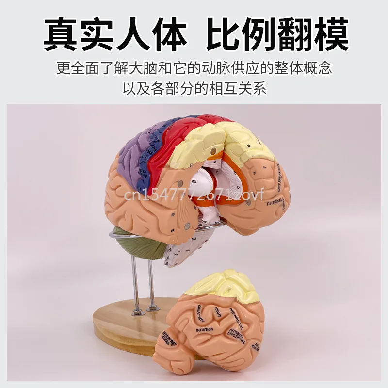 2 Times Magnification 4 Parts Brain Attached Cerebral Artery Model Cerebrovascular Model Neurology Human Brain Anatomy Model