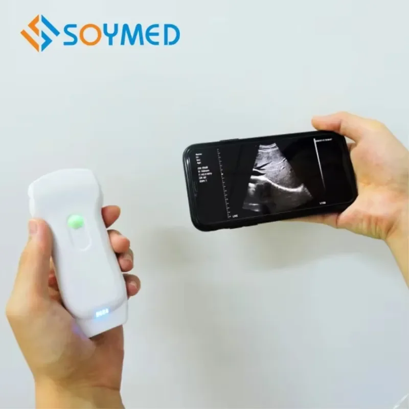 3-in-1 Wireless Pocket Ultrasound Probe – WiFi Smartphone-Compatible for Android & iOS