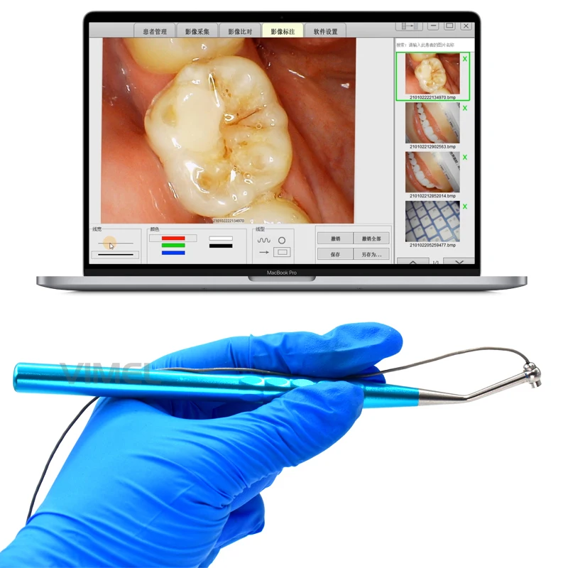 2024 New LED Visual Dental Digital Micro Intra Oral Camera Wireless Foot Control HD Visual Intraoral Observa Tionhandle