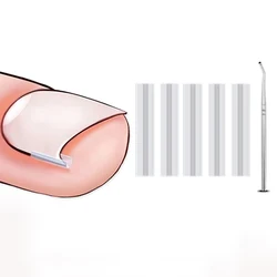 Ingrown Toe Nail Treatment, Elastic Patch Sticker, Straightening Clip, Brace, Pedicure Tools, Ferramenta de Correção Unha, 50Pcs