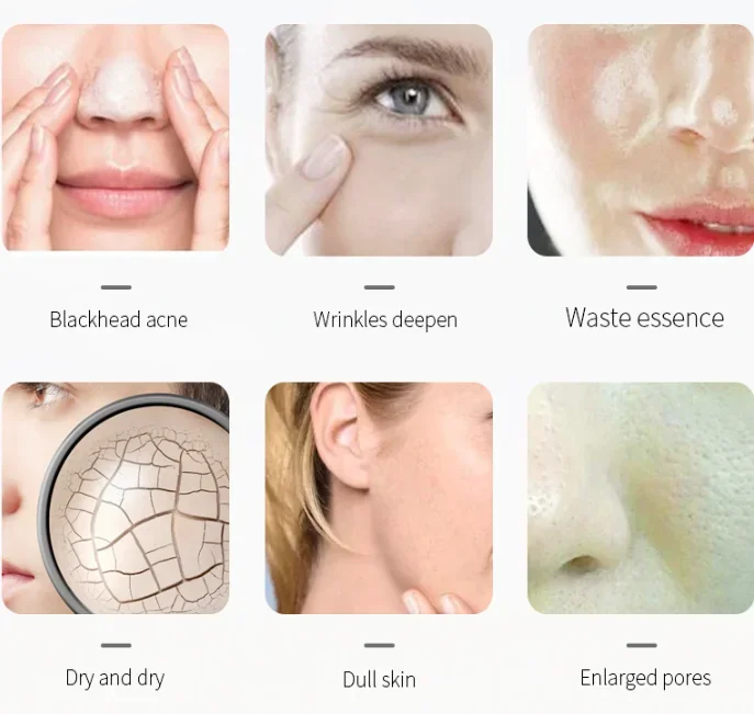 Appareil de lifting du visage et de nettoyage de beauté, appareil de massage par vibration multifonctionnel, alimentation par lumière colorée, exportation et importation de la peau